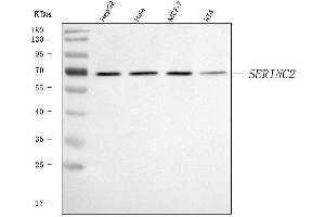 anti-serine Incorporator 2 (SERINC2) (AA 62-378) antibody