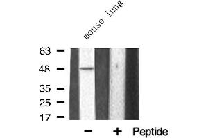 Western blot analysis of TNF Receptor II expression in Mouse lung lysate (TNFRSF1B Antikörper  (C-Term))