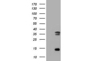 Image no. 2 for anti-Thymidylate Synthetase (TYMS) antibody (ABIN1501593) (TYMS Antikörper)