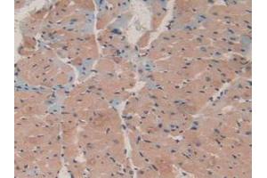 IHC-P analysis of Mouse Heart Tissue, with DAB staining. (MAP1A Antikörper  (AA 2552-2759))