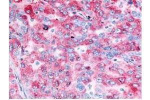 Immunohistochemistry (IHC) image for anti-Epidermal Growth Factor Receptor (EGFR) (C-Term) antibody (ABIN285758) (EGFR Antikörper  (C-Term))