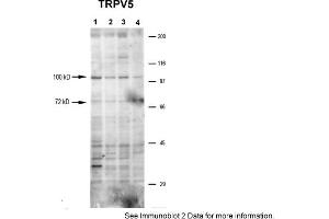 Sample Type: 1-4. (TRPV5 Antikörper  (N-Term))