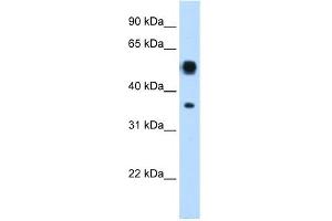 WB Suggested Anti-ASL Antibody Titration:  0. (ASL Antikörper  (N-Term))