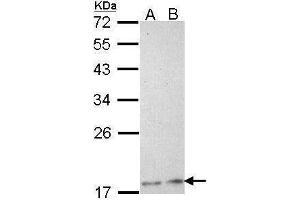 WB Image Sample (30 ug of whole cell lysate) A: H1299 B: Hela 12% SDS PAGE antibody diluted at 1:1000 (PLA2G12A Antikörper)