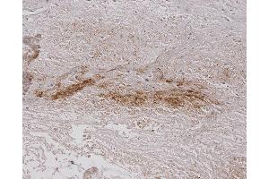 Immunohistochemistry analysis using Mouse Anti-Alginate Monoclonal Antibody, Clone 4B10-1C5 . (Alginate Antikörper (FITC))