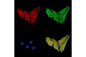 ABIN7095445 and ABIN7099502 staining Hela cells by IF/ICC. (ERP44 Antikörper)