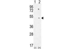 Western Blotting (WB) image for anti-Paraoxonase 1 (PON1) antibody (ABIN2995778) (PON1 Antikörper)