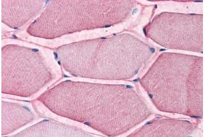 Human Skeletal Muscle: Formalin-Fixed, Paraffin-Embedded (FFPE) (SLC1A5 Antikörper  (Internal Region))