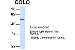 Host:  Rabbit  Target Name:  COLQ  Sample Type:  Human Adult Placenta  Antibody Dilution:  1. (COLQ Antikörper  (N-Term))