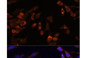 Immunofluorescence analysis of NIH-3T3 cells using PSMB7 Polyclonal Antibody at dilution of 1:100 (40x lens). (PSMB7 Antikörper)
