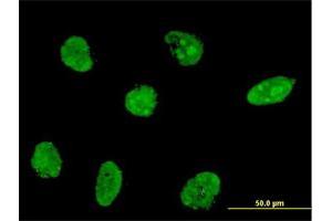 Immunofluorescence of monoclonal antibody to NHLH2 on HeLa cell. (NHLH2 Antikörper  (AA 36-135))