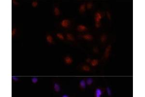 Immunofluorescence analysis of U2OS cells using HOXA2 Polyclonal Antibody at dilution of 1:100. (HOXA2 Antikörper)