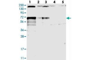 Western blot analysis of Lane 1: RT-4, Lane 2: U-251 MG, Lane 3: Human Plasma, Lane 4: Liver, Lane 5: Tonsil with LTV1 polyclonal antibody  at 1:250-1:500 dilution. (LTV1 Antikörper)
