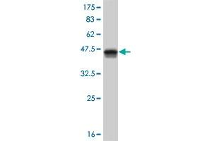 Western Blot detection against Immunogen (37. (HOXB1 Antikörper  (AA 101-210))