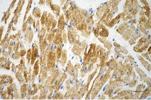 anti-Desmin (DES) antibody