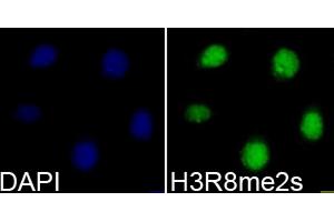 Immunofluorescence analysis of 293T cells using Symmetric DiMethyl-Histone H3-R8 antibody (ABIN3016056, ABIN3016057, ABIN3016058, ABIN1680222 and ABIN6219535). (Histone 3 Antikörper  (H3R8me2))