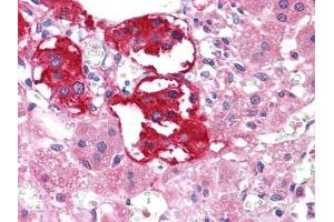 Immunohistochemical analysis of paraffin-embedded human Adrenal tissues using EPHB3 antibody (EPH Receptor B3 Antikörper  (AA 39-212))