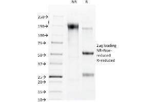 SDS-PAGE Analysis Purified Connexin 32 Mouse Monoclonal Antibody (R5. (GJB1 Antikörper)