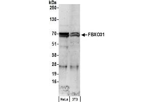 Western Blotting (WB) image for anti-F-Box Protein 31 (FBXO31) (AA 489-539) antibody (ABIN7452935)