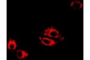 Immunofluorescent analysis of LTA4H staining in Hela cells. (LTA4H Antikörper)