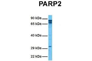 Host:  Rabbit  Target Name:  P Sample Tissue:  Human Hela  Antibody Dilution:  1. (PARP2 Antikörper  (Middle Region))
