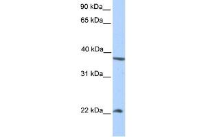 WB Suggested Anti-NEK7 Antibody Titration:  0.