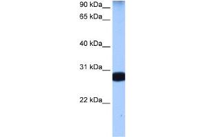 WB Suggested Anti-STAU1 Antibody Titration:  0. (STAU1/Staufen Antikörper  (N-Term))