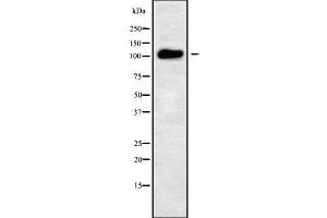 Western blot analysis of ATP2C2 using LOVO whole cell lysates (ATP2C2 Antikörper  (Internal Region))