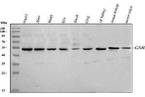 Western blot analysis of Glutathione Reductase using anti-Glutathione Reductase antibody (ABIN5693151).