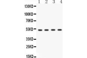 Western blot analysis of BDKRB2 expression in HELA whole cell lysates ( Lane 1), HEPG2 whole cell lysates ( Lane 2), MCF-7 whole cell lysates ( Lane 3) and A549 whole cell lysates ( Lane 4). (BDKRB2 Antikörper  (C-Term))