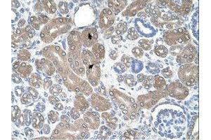 Image no. 1 for anti-ST3 beta-Galactoside alpha-2,3-Sialyltransferase 5 (ST3GAL5) (AA 151-200) antibody (ABIN321105) (ST3GAL5 Antikörper  (AA 151-200))