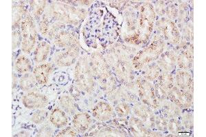 Paraformaldehyde-fixed, paraffin embedded rat kidney tissue, Antigen retrieval by boiling in sodium citrate buffer(pH6) for 15min, Block endogenous peroxidase by 3% hydrogen peroxide for 30 minutes, Blocking buffer (normal goat serum) at 37°C for 20min, Antibody incubation with Rabbit Anti-FCAR Polyclonal Antibody, Unconjugated  at 1:500 overnight at 4°C, followed by a conjugated secondary and DAB staining (FCAR Antikörper  (AA 131-230))