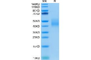 IL-10RA Protein (AA 22-235) (His-Avi Tag)