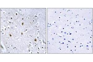 Immunohistochemistry (IHC) image for anti-Insulin Receptor Substrate 1 (IRS1) (AA 605-654) antibody (ABIN2889012) (IRS1 Antikörper  (AA 605-654))