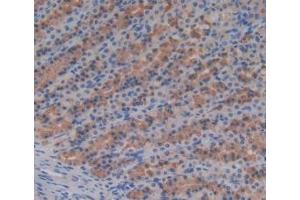 Immunohistochemistry (IHC) image for anti-serpin Peptidase Inhibitor, Clade A (Alpha-1 Antiproteinase, Antitrypsin), Member 6 (SERPINA6) (AA 173-344) antibody (ABIN7428320)