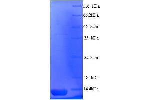 SDS-PAGE (SDS) image for Alopecia, Androgenetic, 2 (AGA2) (AA 19-87) protein (His tag) (ABIN5714098) (AGA2 Protein (AA 19-87) (His tag))
