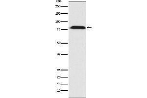 Western blot analysis of MAD1 expression in A431 cell lysate.