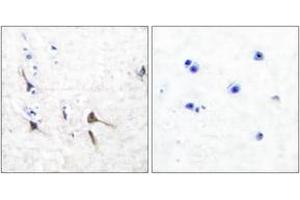 Immunohistochemistry analysis of paraffin-embedded human brain tissue, using Potassium Channel Kv3. (Kv3.2b Potassium Channel Antikörper  (AA 589-638))