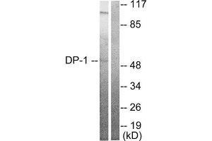 Western Blotting (WB) image for anti-Transglutaminase 4 (Prostate) (TGM4) (C-Term) antibody (ABIN5976383) (TGM4 Antikörper  (C-Term))