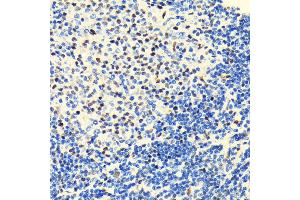 Immunohistochemistry of paraffin-embedded rat spleen using HD antibody (ABIN7267708) at dilution of 1:100 (40x lens).
