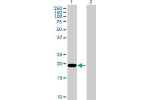 Western Blot analysis of LTA expression in transfected 293T cell line by LTA MaxPab polyclonal antibody. (LTA Antikörper  (AA 1-205))