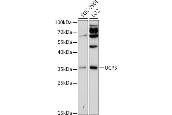 UCP3 Antikörper  (AA 1-110)