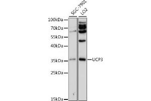 Western blot analysis of extracts of various cell lines, using UCP3 antibody (ABIN3022085, ABIN3022086, ABIN3022087, ABIN1513663 and ABIN6218600) at 1:500 dilution. (UCP3 Antikörper  (AA 1-110))