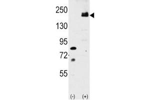 Western blot analysis of LRP6 antibody and 293 cell lysate either nontransfected or transiently transfected with the LRP6 gene. (LRP6 Antikörper  (AA 1531-1560))