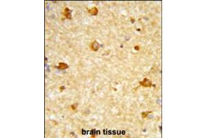 Formalin-fixed and paraffin-embedded human brain tissue reacted with DIRAS1 Antibody , which was peroxidase-conjugated to the secondary antibody, followed by DAB staining.