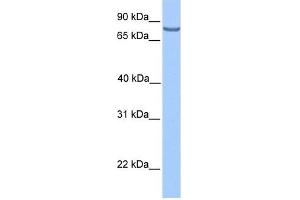 LCA5 antibody used at 1 ug/ml to detect target protein. (LCA5 Antikörper  (N-Term))