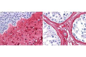 anti collagen III antibody (600-401-105 Lot 26016, 1:400, 45 min RT) showed strong staining in FFPE sections of human skin(left, dermis) with moderate to strong red staining and testis (right) where strong staining was observed within connective tissue between seminiferous tubules. (COL3 Antikörper  (FITC))