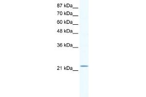 WB Suggested Anti-RGS10 Antibody   Titration: 1. (RGS10 Antikörper  (Middle Region))