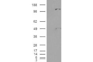 Western Blotting (WB) image for anti-Pyruvate Carboxylase (PC) (Internal Region) antibody (ABIN2466170) (PC Antikörper  (Internal Region))