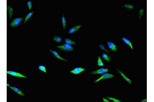 Immunofluorescence (IF) image for anti-Cyclin-Dependent Kinase Inhibitor 2B (p15, Inhibits CDK4) (CDKN2B) (AA 1-138) antibody (ABIN7148885)